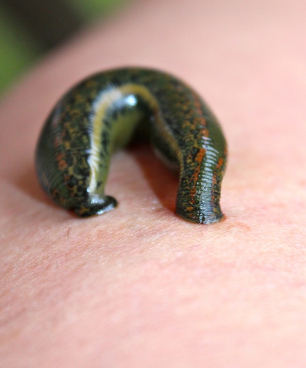 Medycyna naturalna, czyli leczenie pijawkami